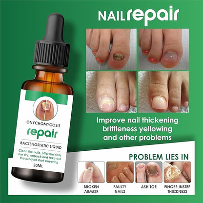 Professional Nail Repair Serum (Buy 1 Get 1)