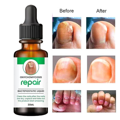 Professional Nail Repair Serum (Buy 1 Get 1)