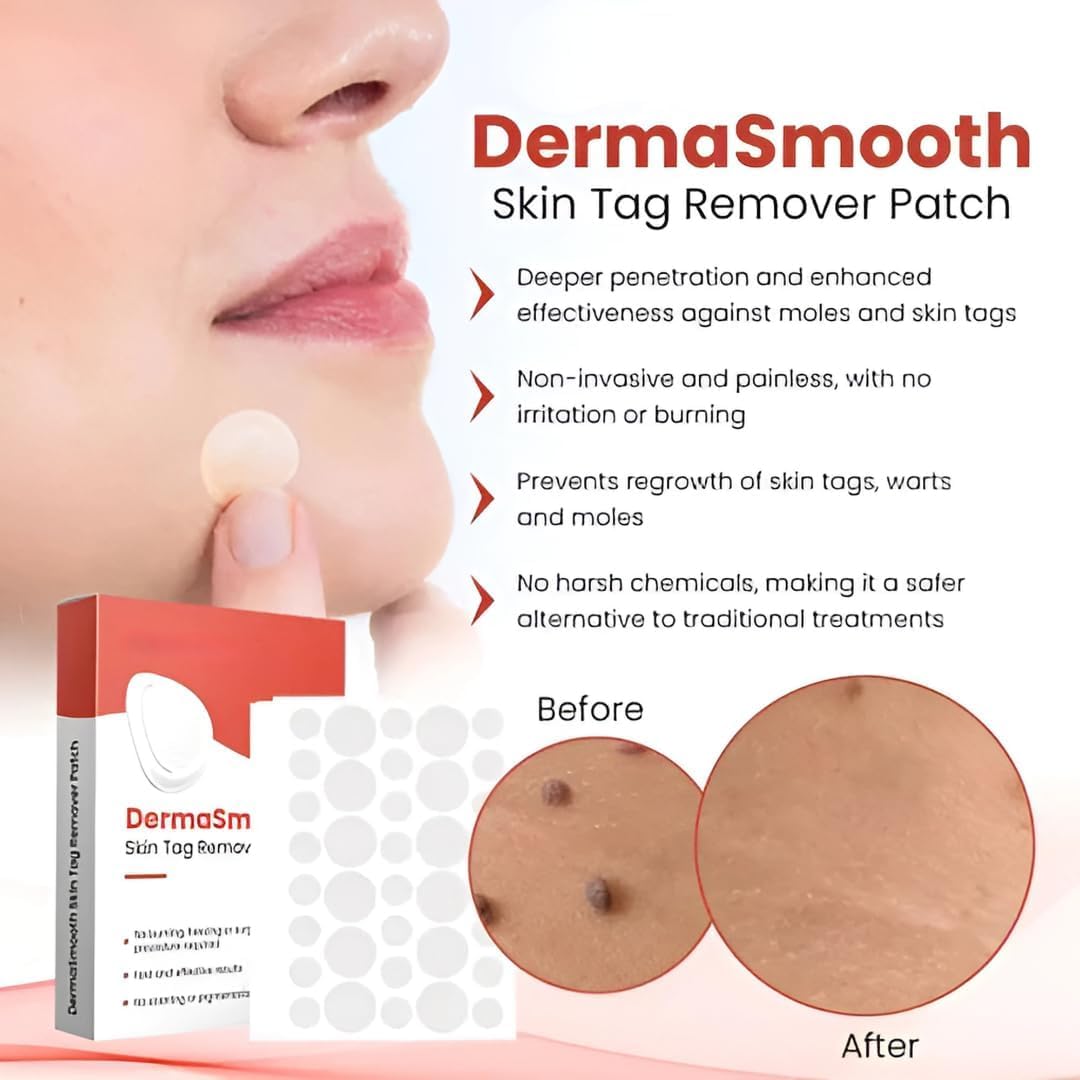 SkinSmooth™ – Skin Tag Removal Patch (Pack of 2)