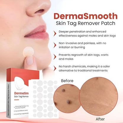DermaSmooth Skin Tag Remover Patch – Painless Skin Care Solution